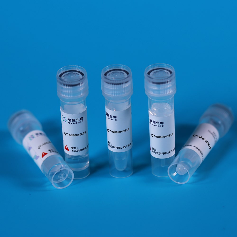 Monoclonal Antibody to Immunoglobulin G (IgG)