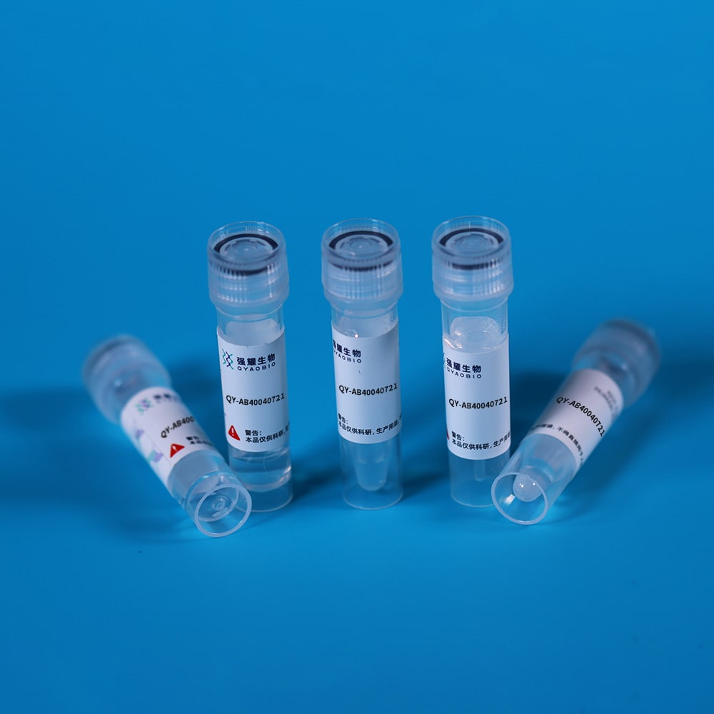 Monoclonal Antibody to Immunoglobulin G (IgG)