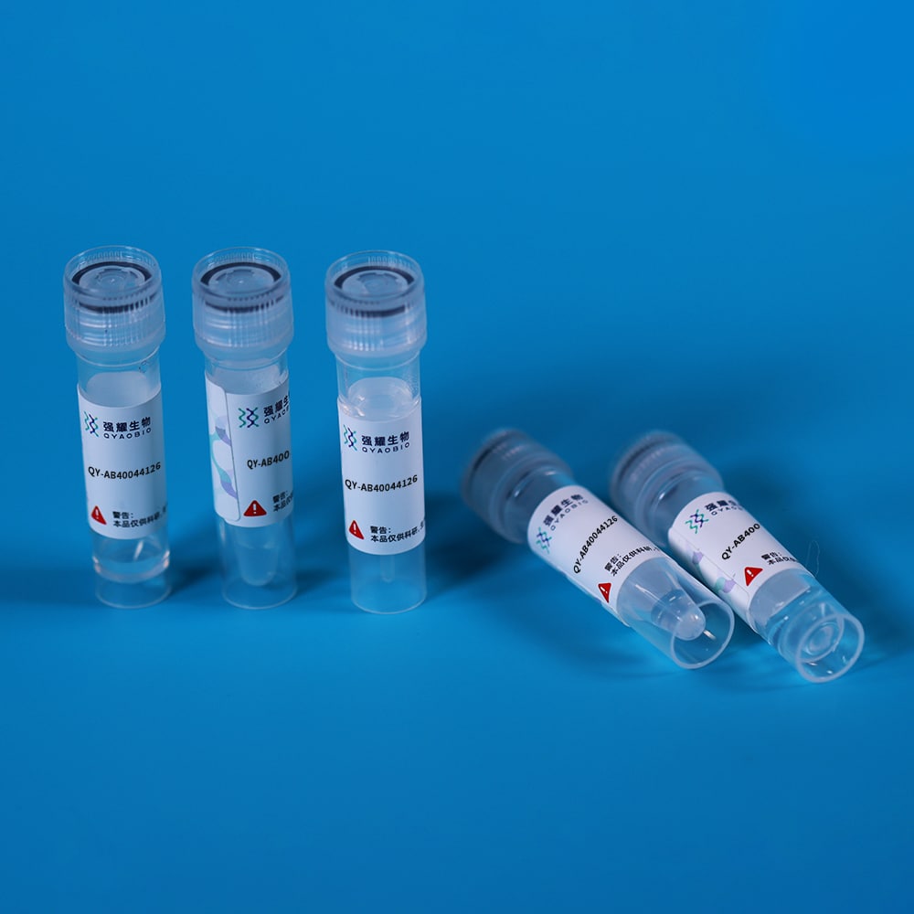 Monoclonal Antibody to Immunoglobulin G (IgG)