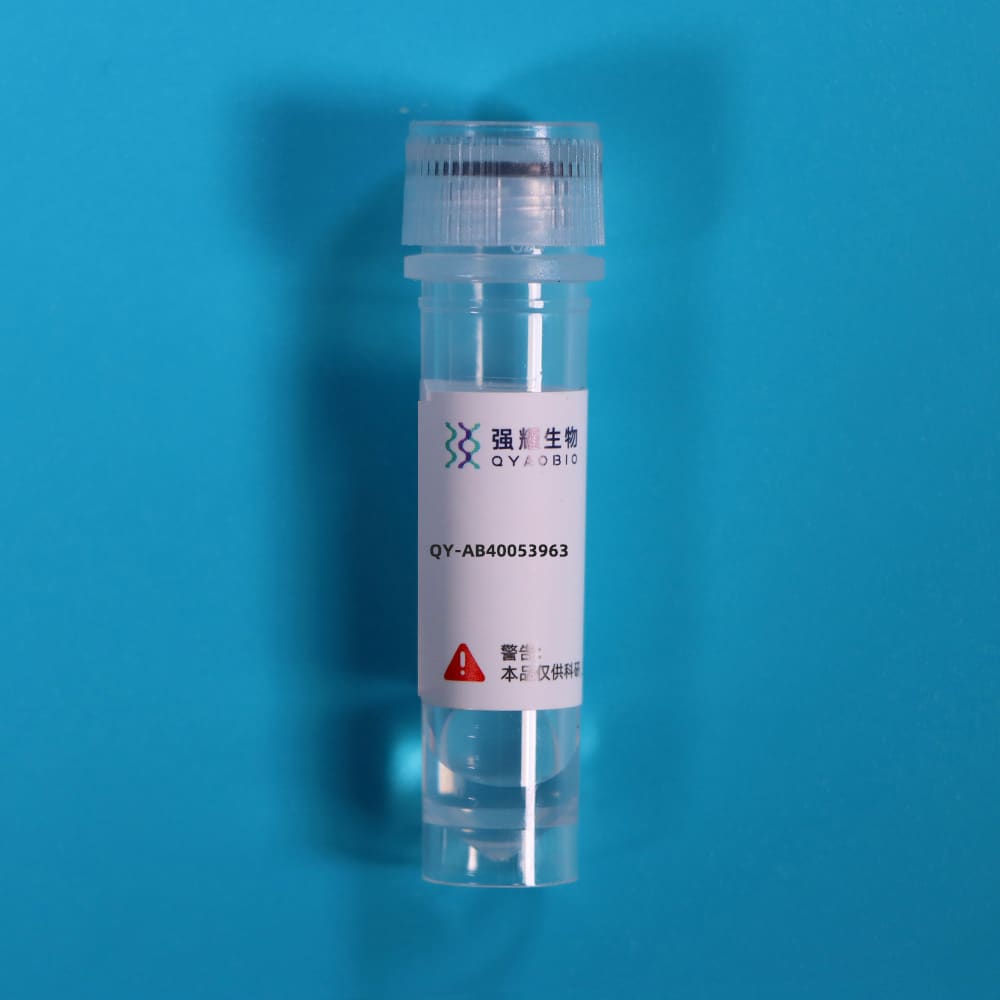 Anti-Activated Leukocyte Cell Adhesion Molecule (ALCAM) Polyclonal Antibody