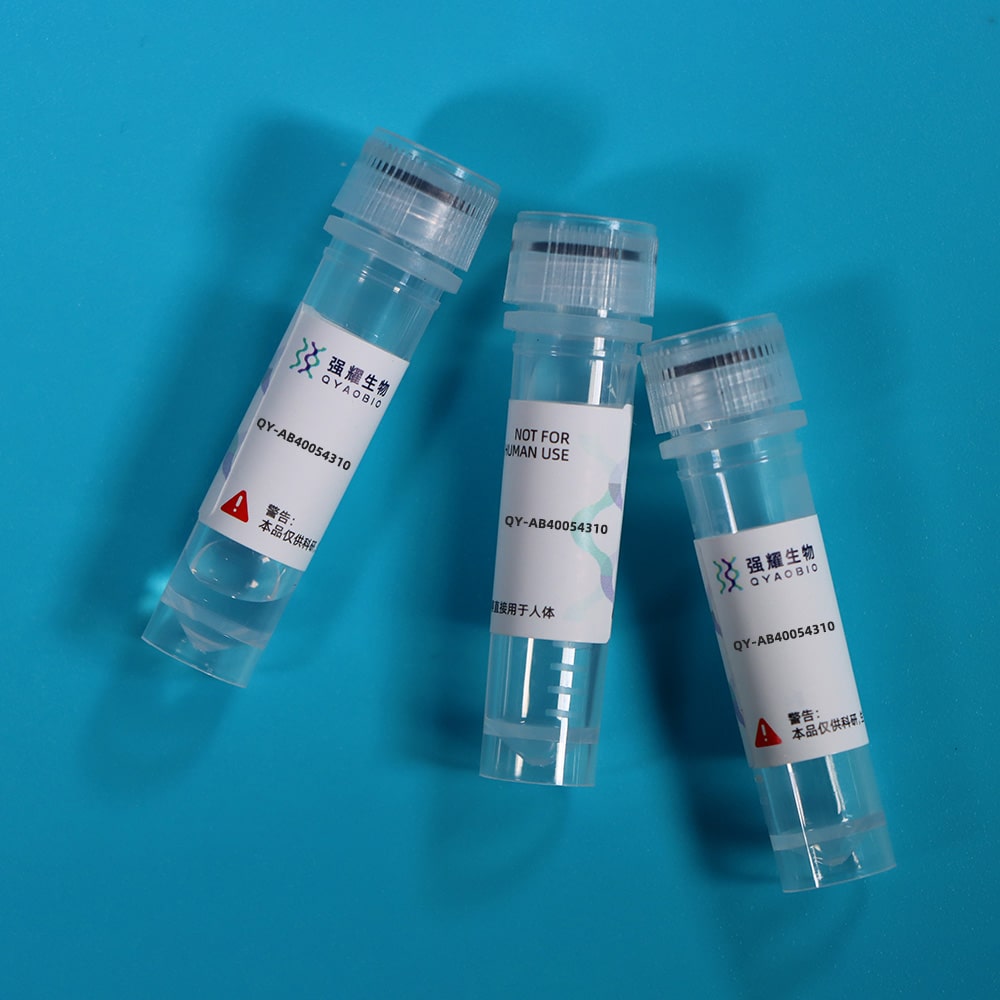 Anti-B-Cell Linker Protein (BLNK) Polyclonal Antibody