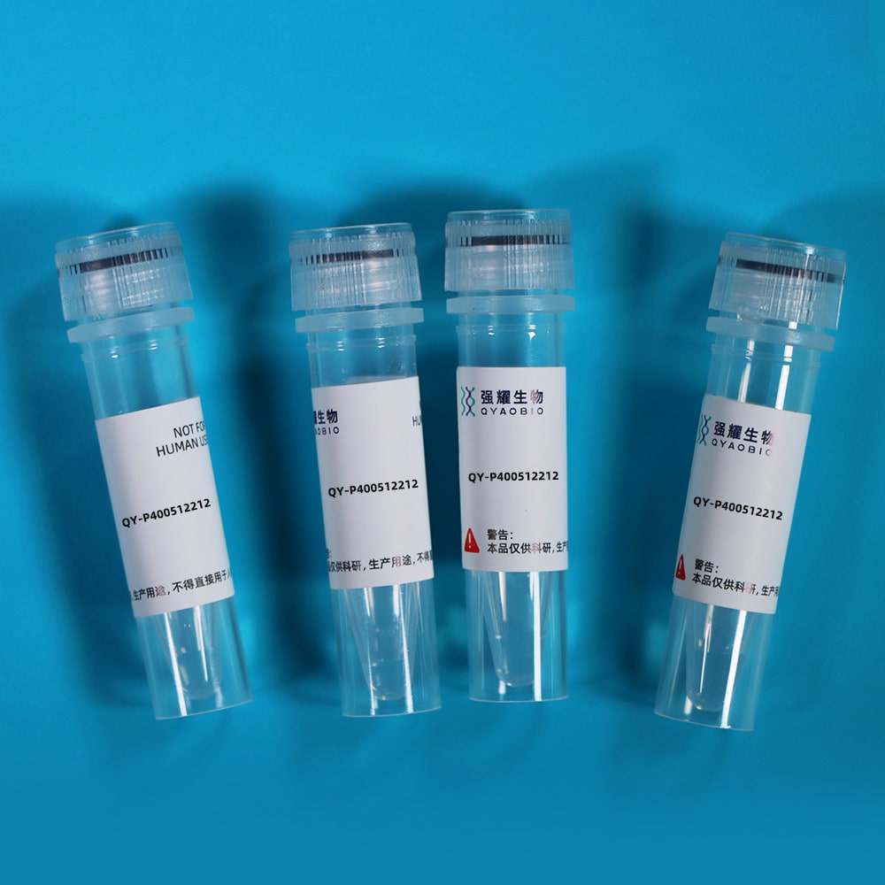 Recombinant Activated Leukocyte Cell Adhesion Molecule (ALCAM)