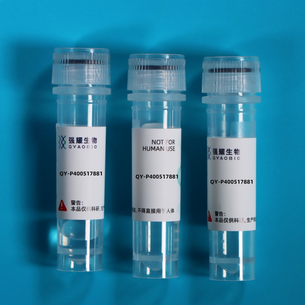 Recombinant Acid Phosphatase 5, Tartrate Resistant (ACP5)