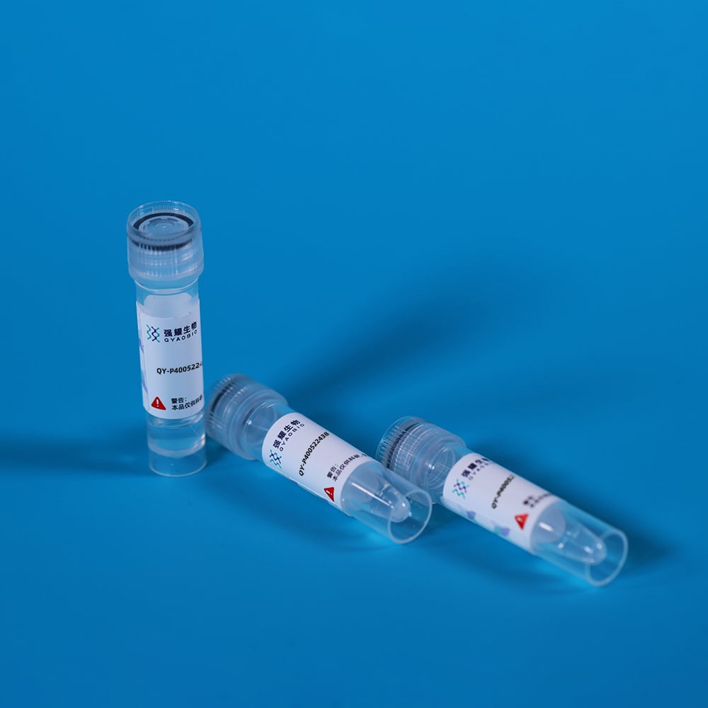 Recombinant 15-Lipoxygenase-2 (15-LO-2)