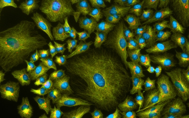 Yeast expression methods